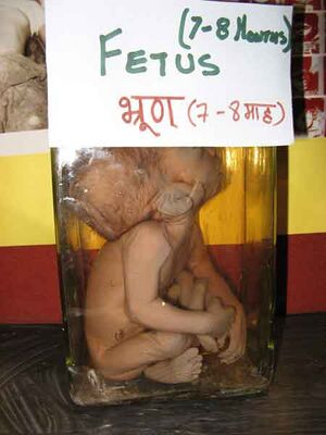 Fetus in a jar.jpg