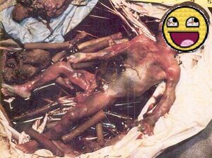 Abortionissgudd..jpg