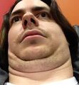 The grotesque accumulation of fat that Arin calls a face.