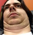 The grotesque accumulation of fat Arin calls a face.