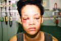 One of Geragos' clients did this to a woman's face.